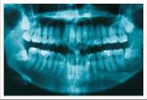 dentes